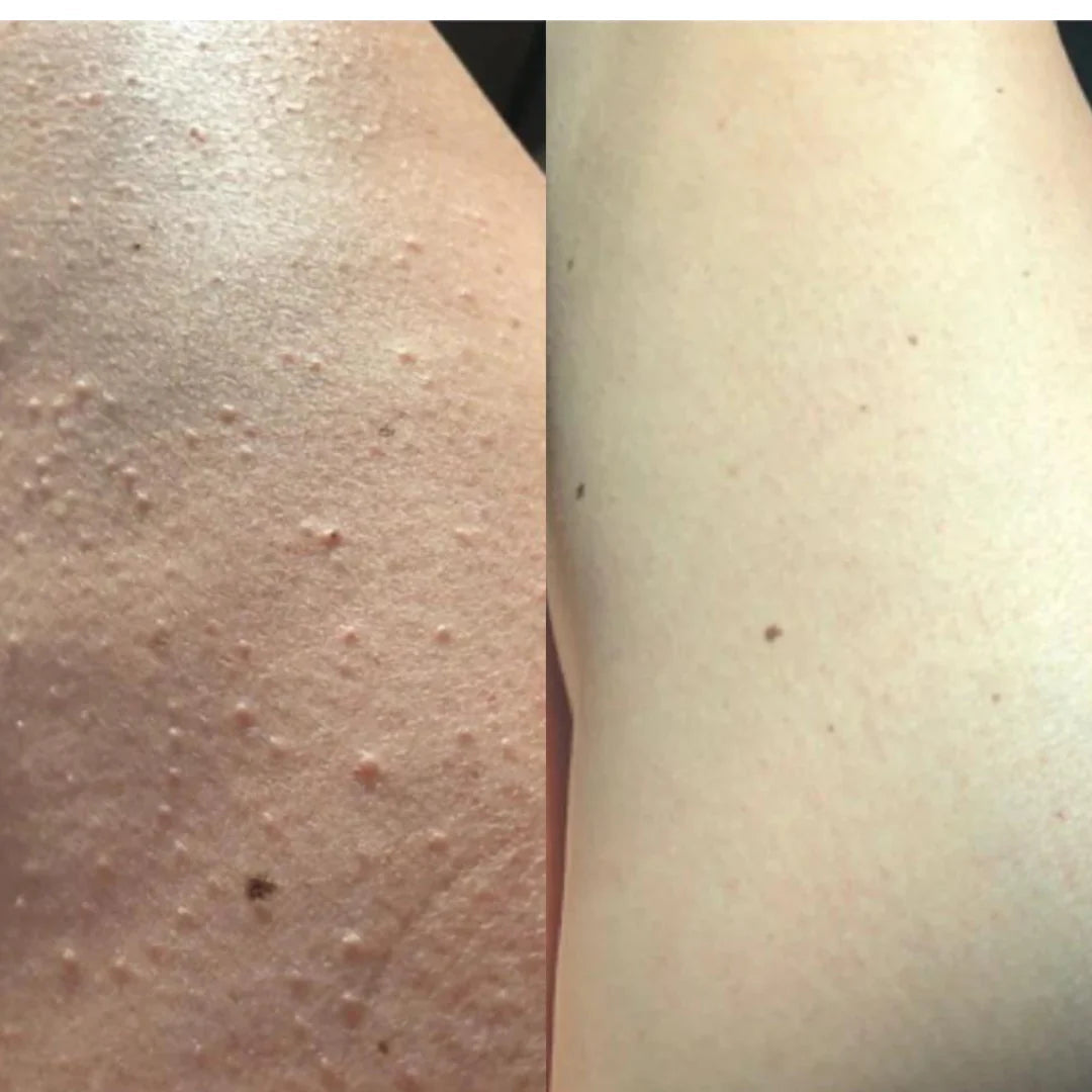 Luvixiaglow — Sérum naturel qui ralentit la repousse des poils