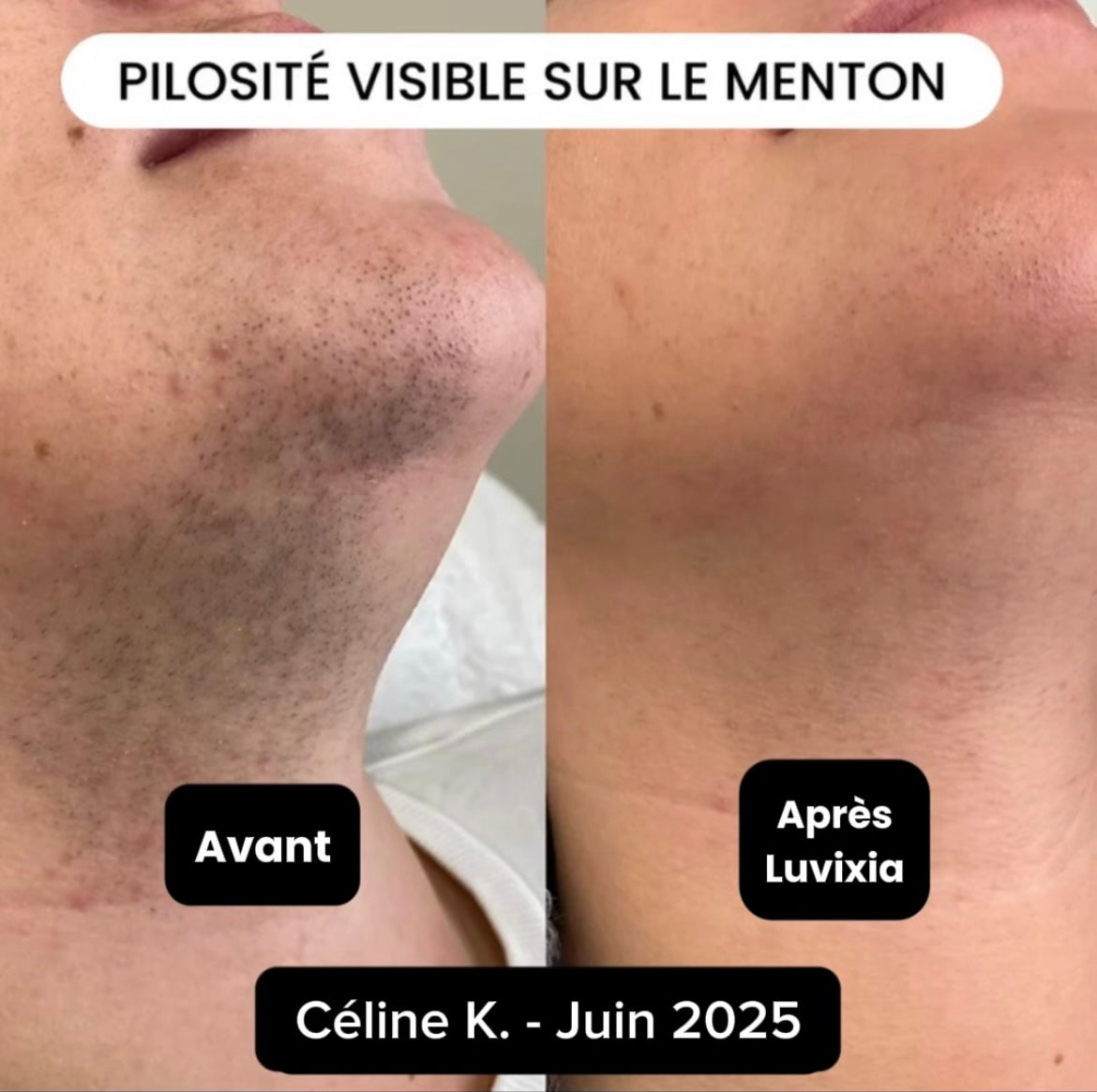 Luvixiaglow — Sérum naturel qui ralentit la repousse des poils