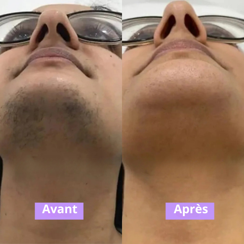 Luvixiaglow — Sérum naturel qui ralentit la repousse des poils