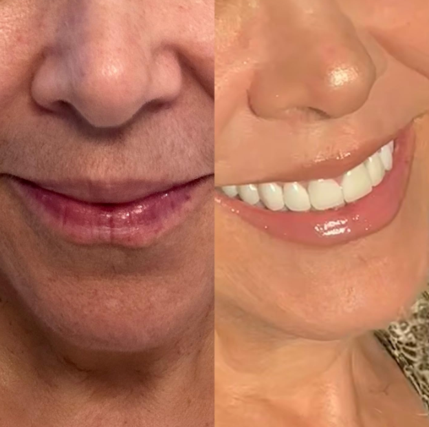 Luvixiaglow — Sérum naturel qui ralentit la repousse des poils