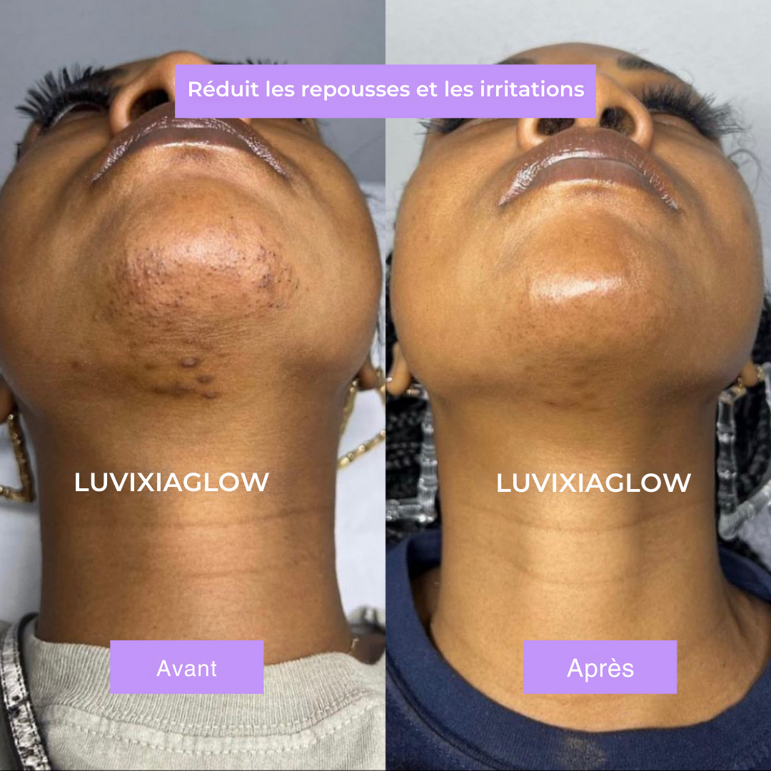 Luvixiaglow — Sérum naturel qui ralentit la repousse des poils
