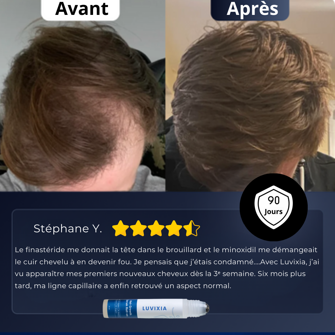 Luvixia – Roll-On Croissance Naturelle Cheveux & Barbe